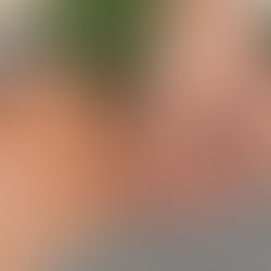 Post-operative Manual Lymphatic Drainage: The Latest Research