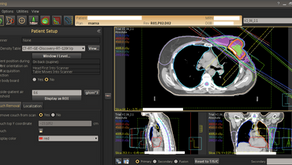 RADIOTERAPIA EN CÀNCER DE MAMAL