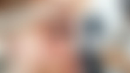 Diabetes: abra os olhos para a saúde da sua visão