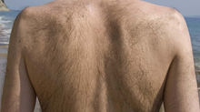 Should I get my back waxed?