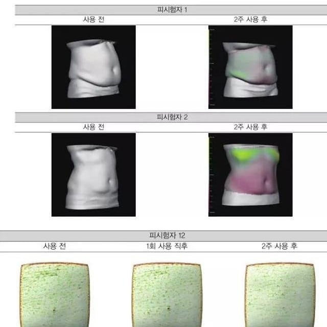 縮圖：韓國 NULINE 家用瘦身溶脂儀