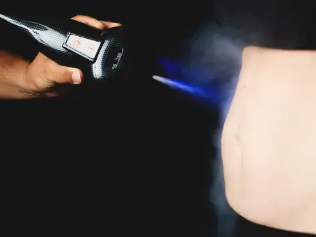 CO2 Cryotherapy for Athletes in Boca Raton: Fast Recovery, Zero Downtime