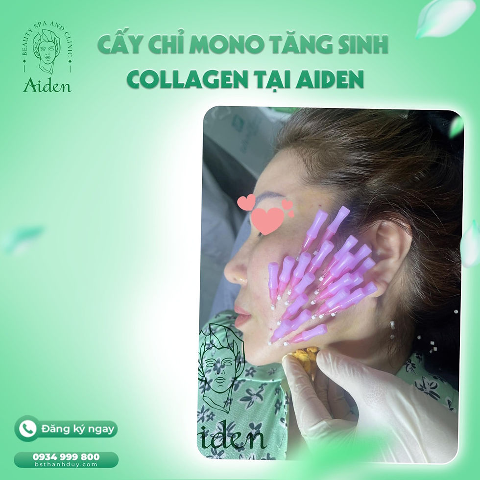 Căng chỉ da mặt trẻ hóa nâng cơ