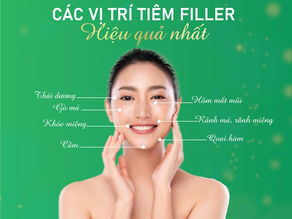 Tiêm filler hiệu quả nhất ở những vùng nào