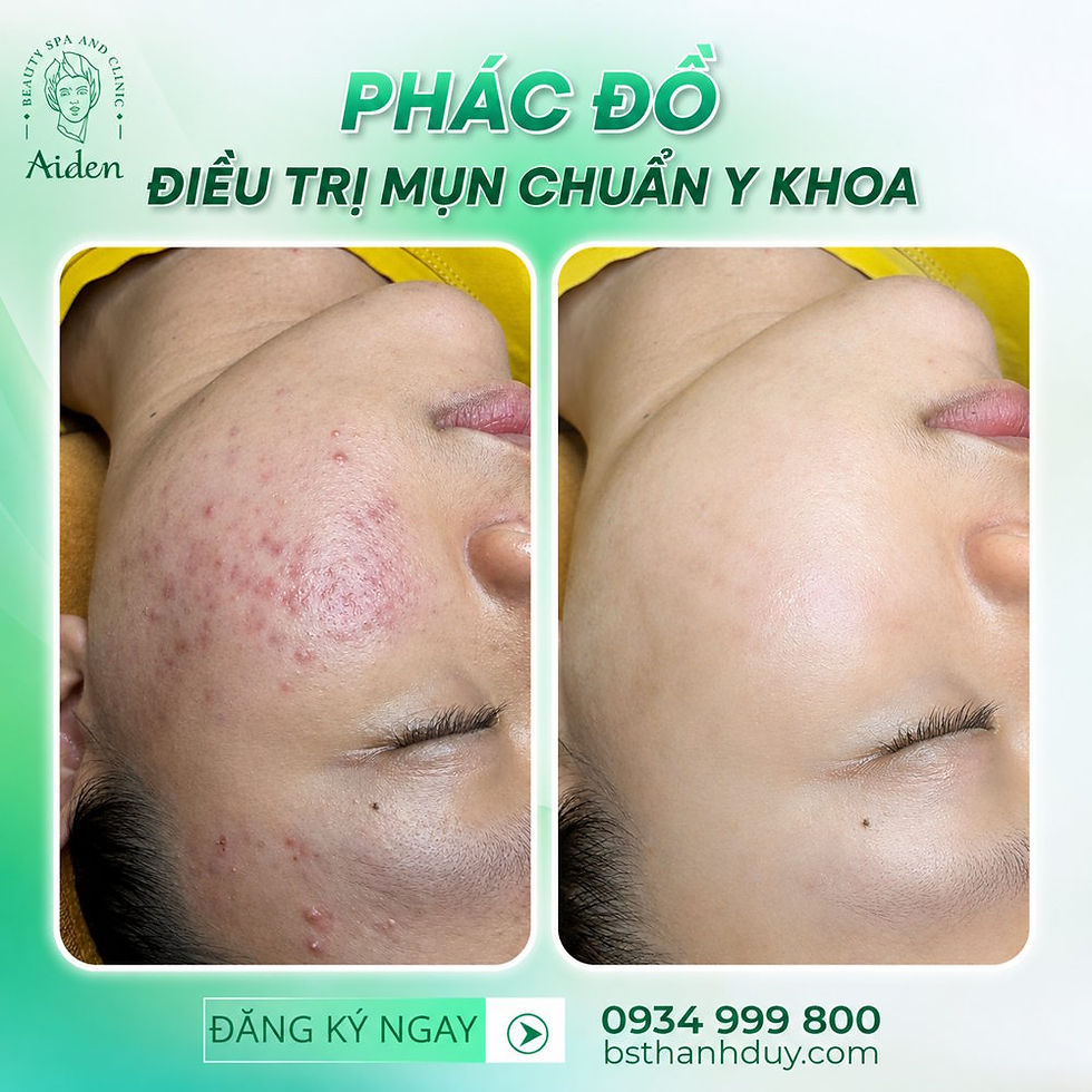 Phác đồ điều trị mụn và phục hồi da căng bóng cùng bác sĩ