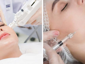 Mesotherapy Machine vs. Manual Injection
