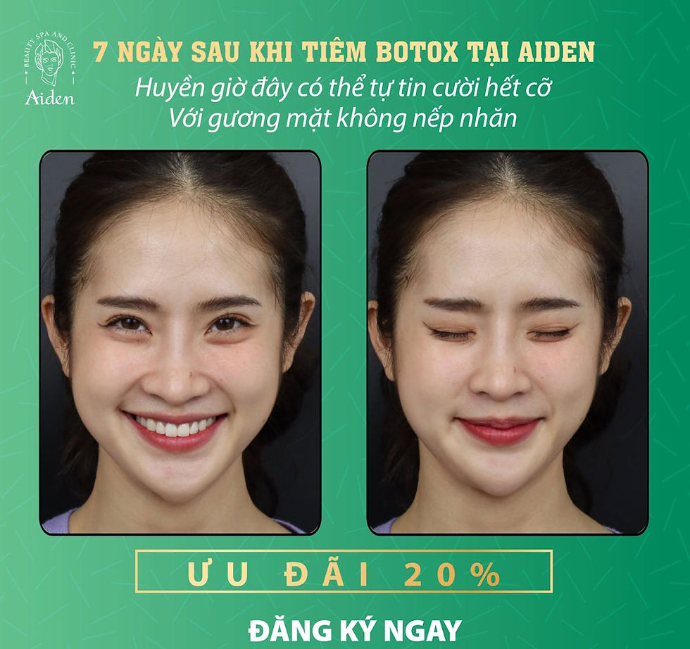 Tiêm Botox cau mày
