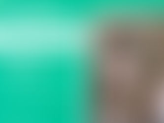 Tiêm filler cằm có hiệu quả không?