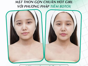 Những lưu ý trước khi tiêm botox