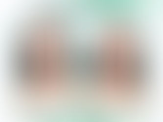 Những lưu ý trước khi tiêm botox