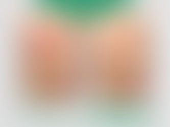 Laser điều trị sẹo rỗ