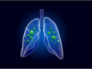 Púlmones con metapneumovirus humano (hMPV) 