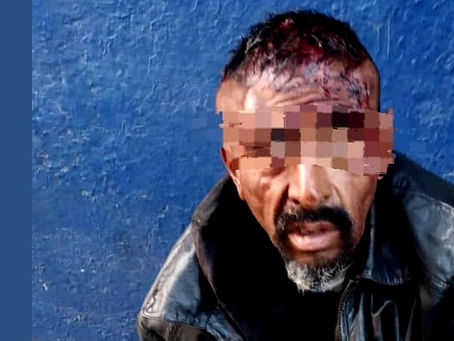 ¡IMÁGENES FUERTES! Policía de Metepec, evita que un delincuente sea linchado