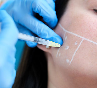Bruxism_botox_thumnail.jpg