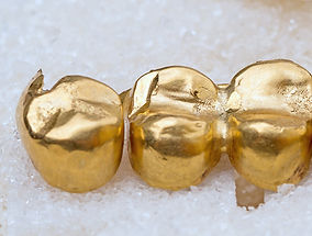 Gold Crown