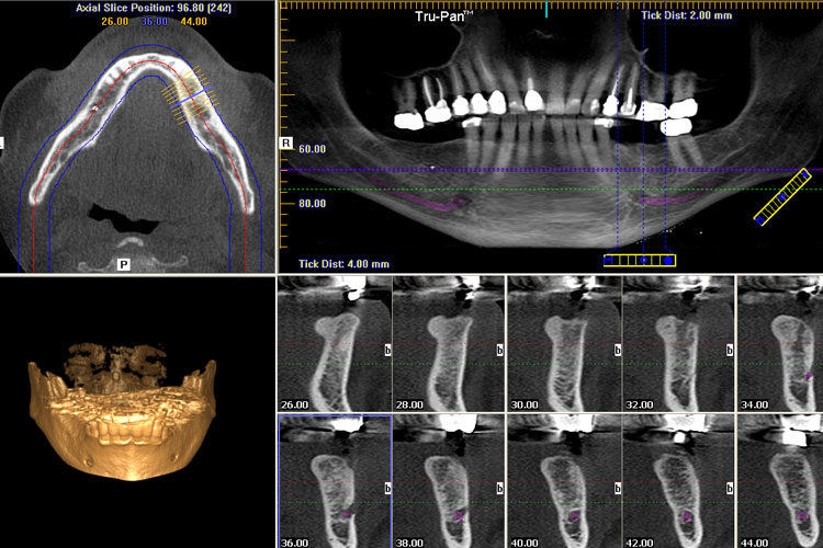 Los 10 básicos de la tomografía dental. Conceptos que tienes que conocer.