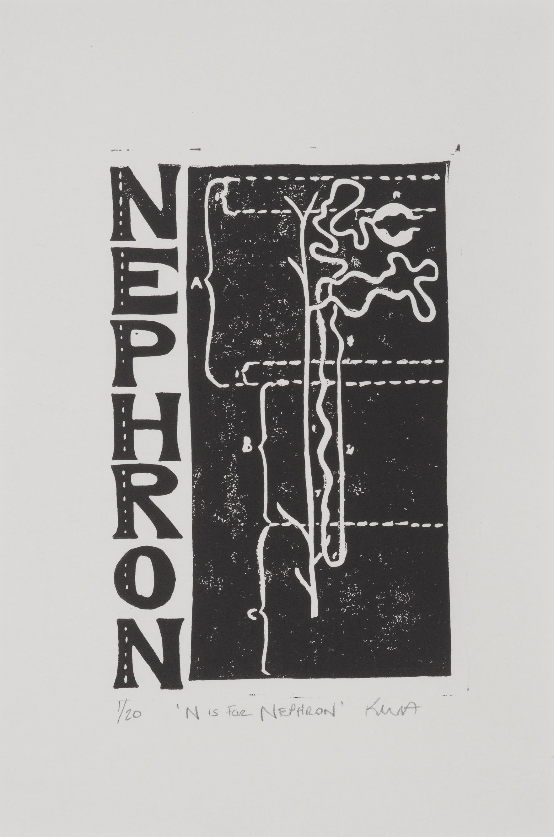 N is for Nephron