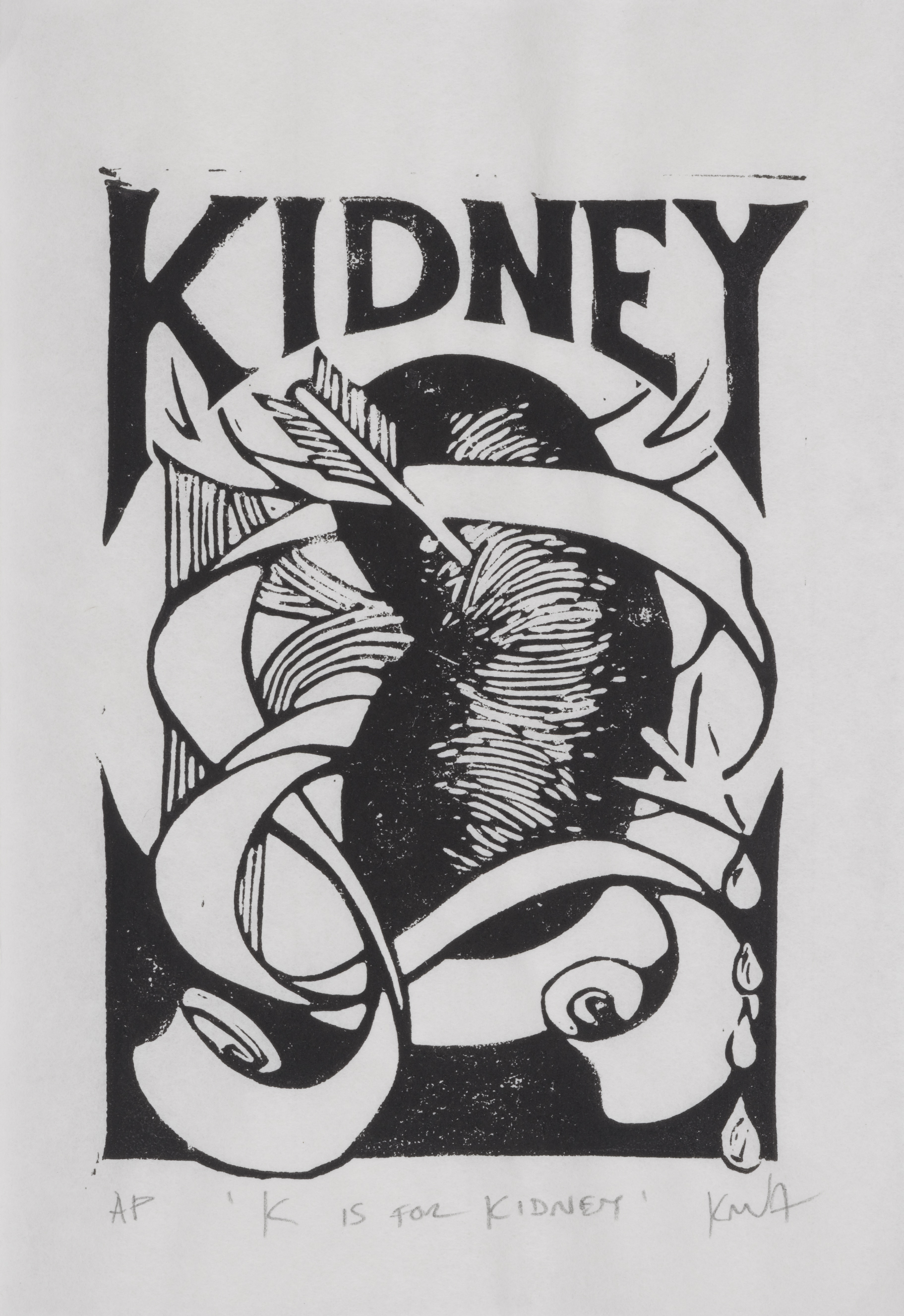 K is for Kidney (2)