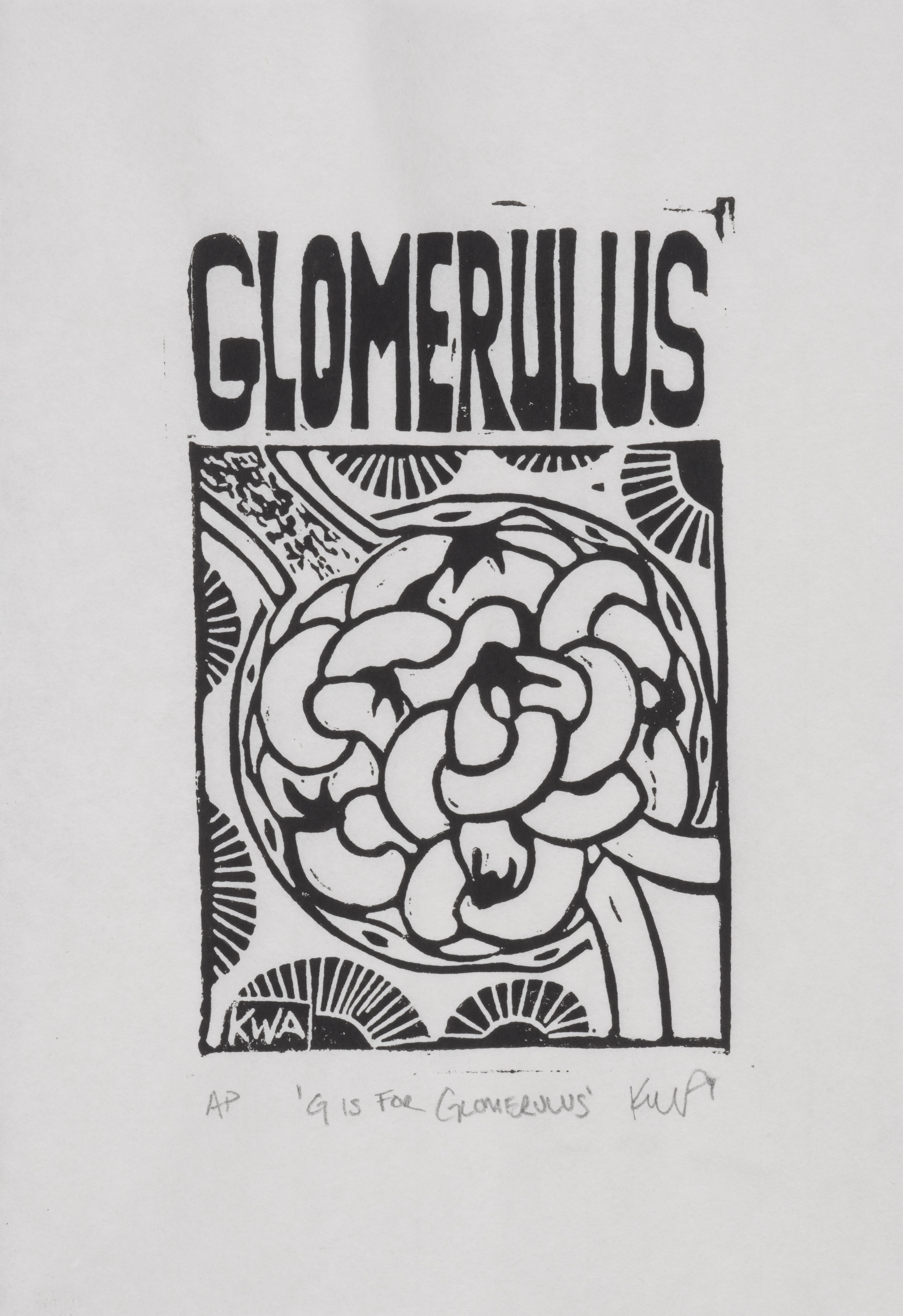 G is for Glomerulus