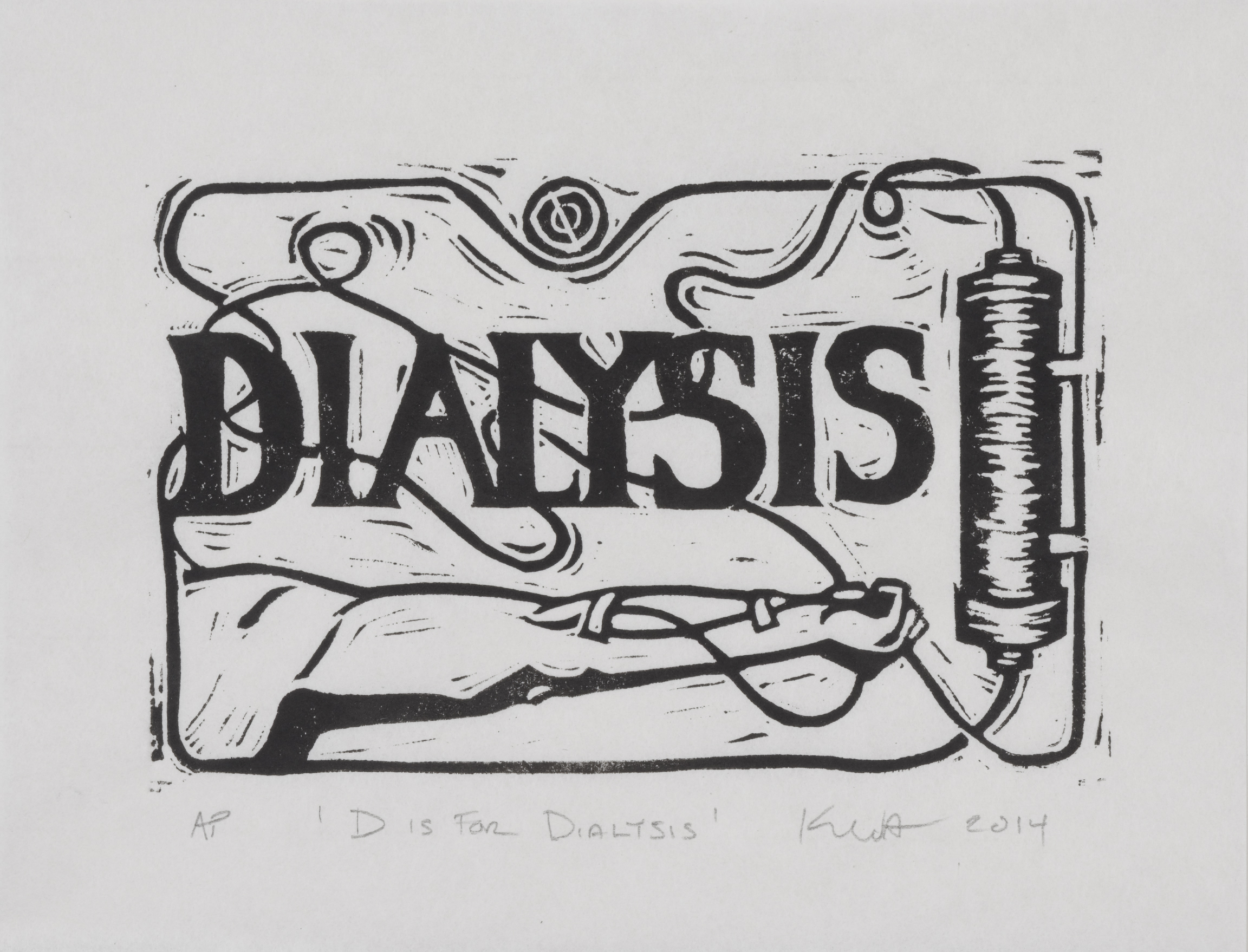 D is for Dialysis
