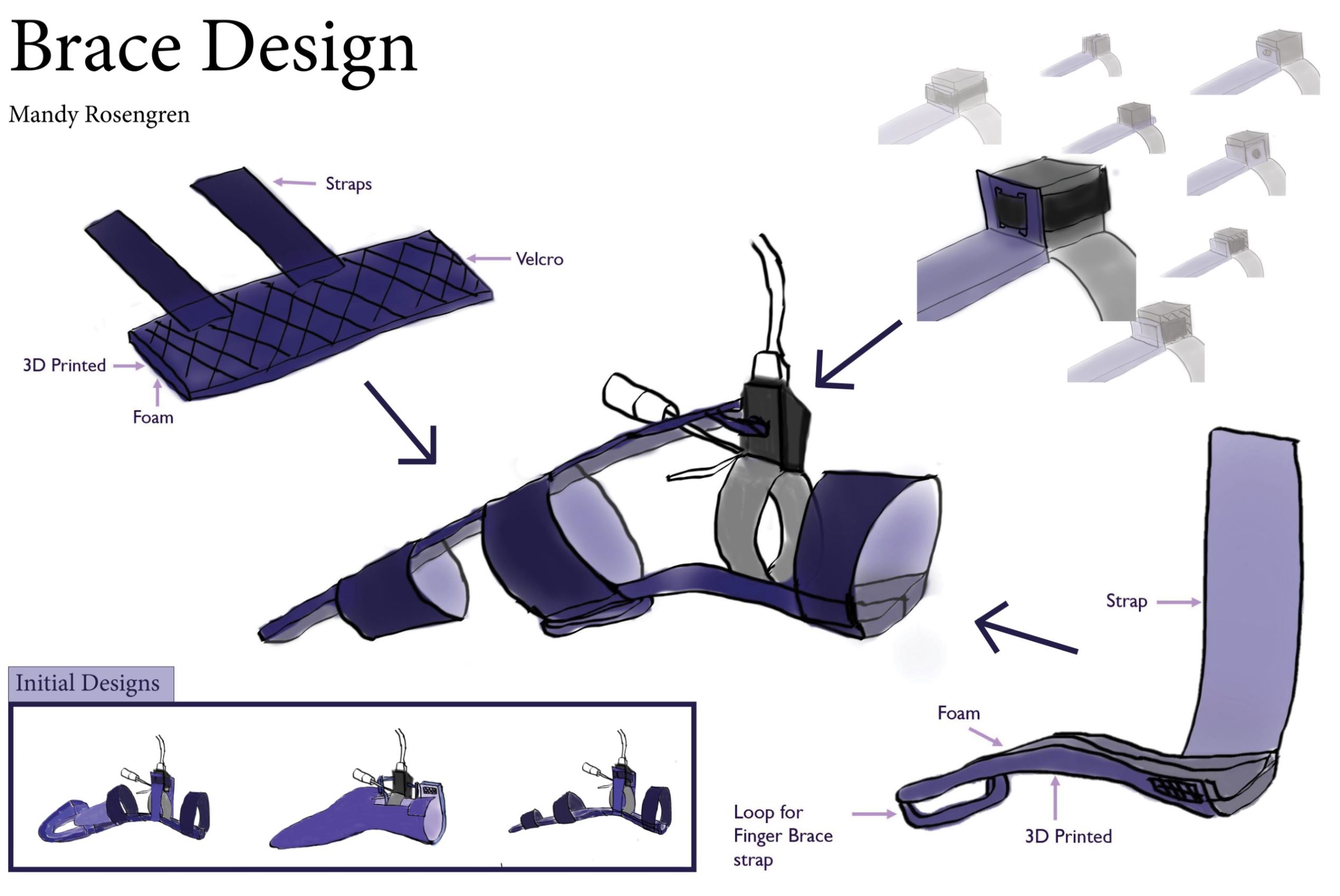 Brace Design