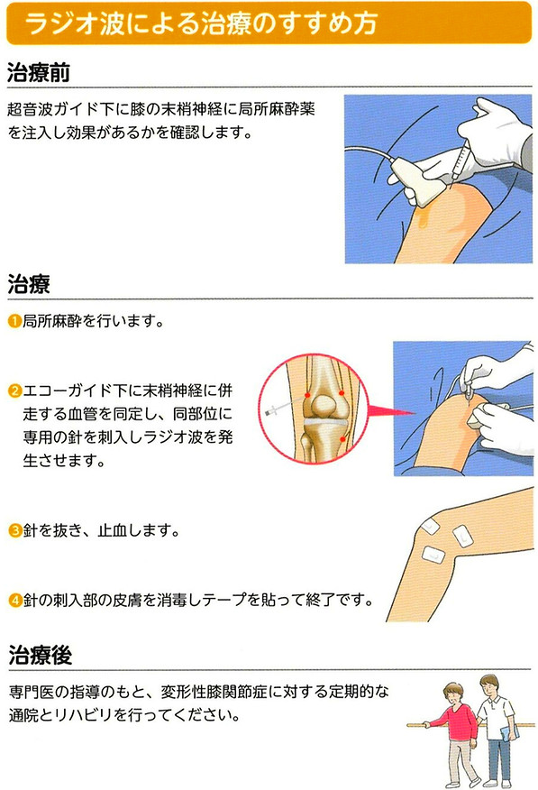 ラジオ波治療