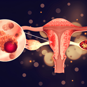 A Austrália pode ser o primeiro país a alcançar a eliminação do câncer do colo do útero