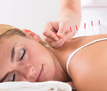 Acupuncture treatment at Bethnal Green Stiff Neck & Shoulders Lower Back Pain Tennis Elbow Knee Pain Sports injury Skeleton balance Ligament muscle problem Sciatica Arthritis