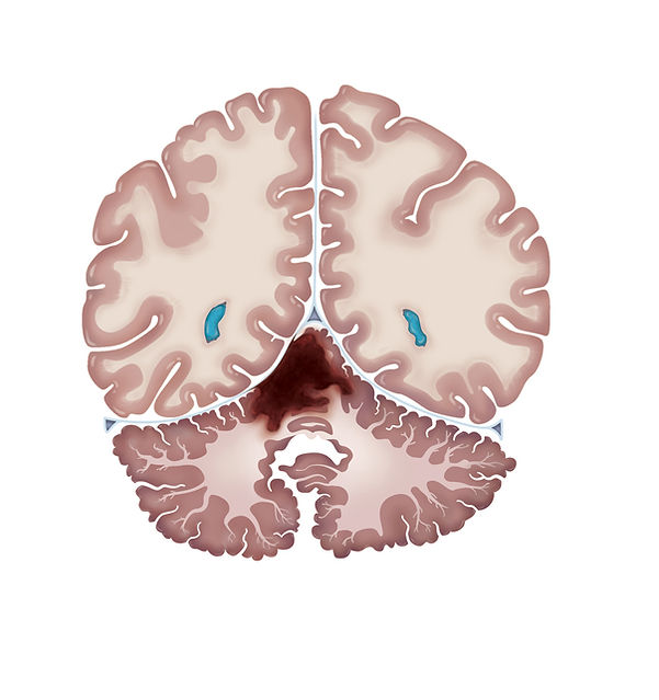 MRI render 1