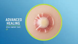 Top Solutions for Advanced Wound Care Solutions