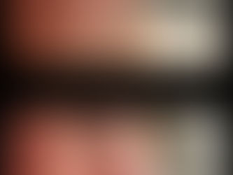 FILS TENSEURS RESORBABLES