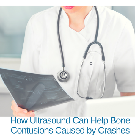 How Ultrasound Can Help Bone Contusions Caused by Crashes