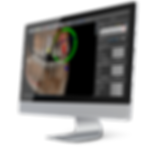 3d dental implant surgery software BlueSkyPlan
