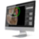 3d dental implant surgery software BlueSkyPlan
