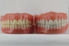 blueskyplan denture module sample