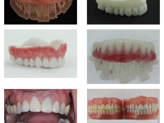 Time is Running Out for FREE DENTURE EXPORTS