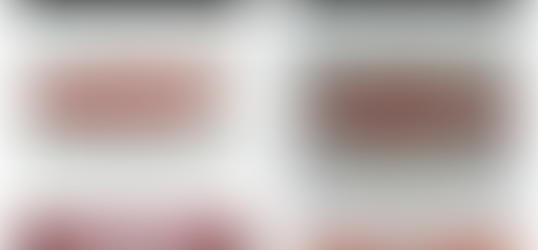 Time is Running Out for FREE DENTURE EXPORTS