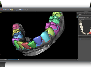 Blue Sky Ortho Beta Release