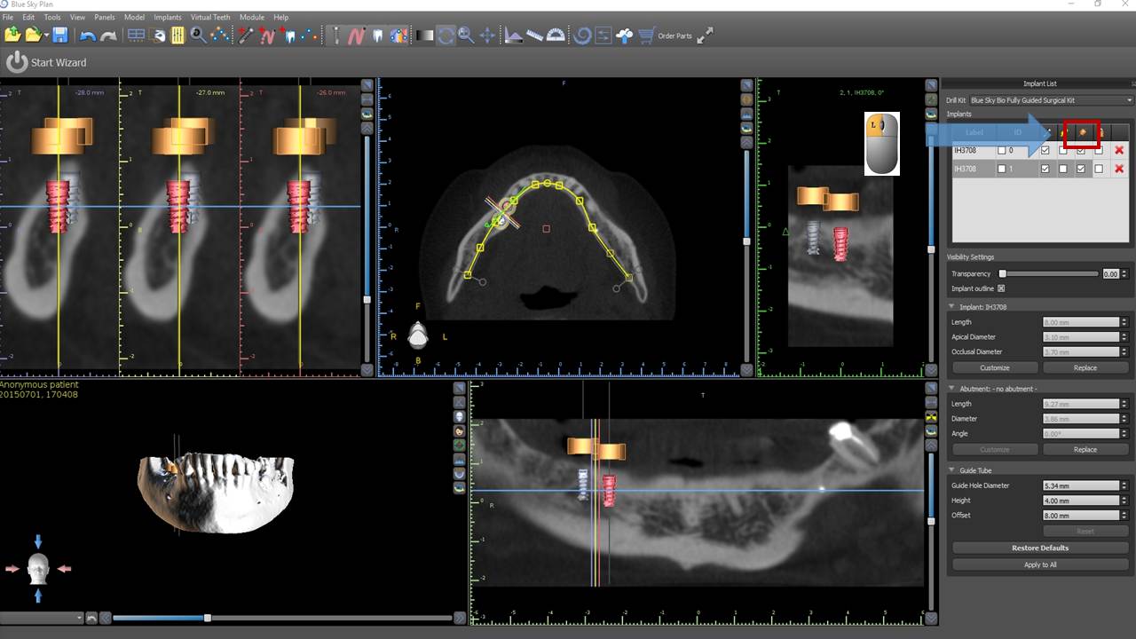 FAQ for BlueSkyPlan software United States Blue Sky Plan