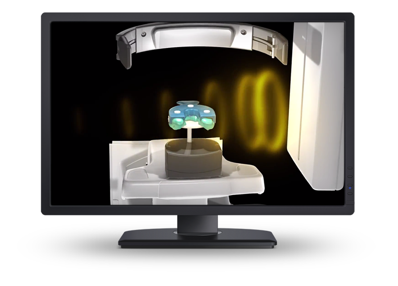 CBCT scan