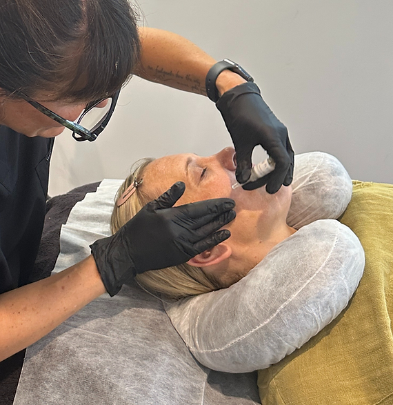 SQT Bio-Microneedling