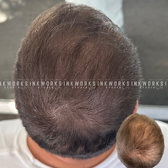 SMP Before and After