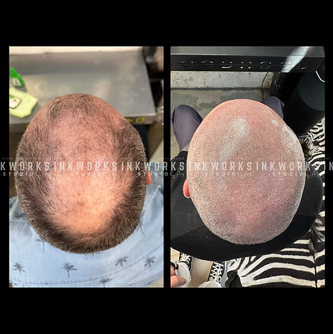 SMP Before and After