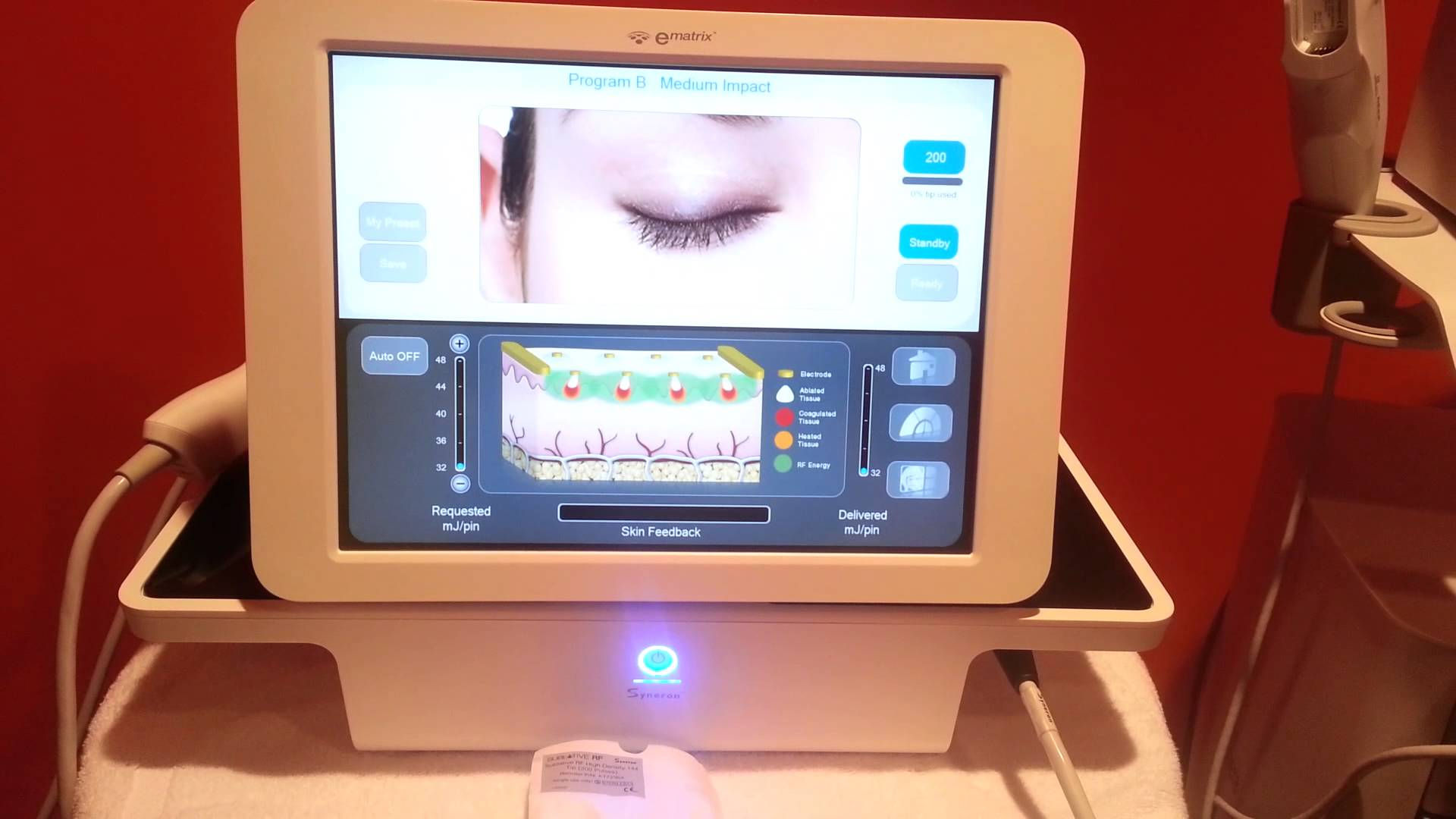 Candela Syneron eTwo e 2 e2 eMatrix Laser IR RF Matrix