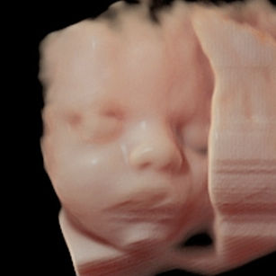 32 weeks 1 day pregnant 3d ultrasound picture of baby's face in virtual HD