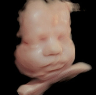 3d ultrasound picture 29 weeks 6 days picture baby's face in virtual HD