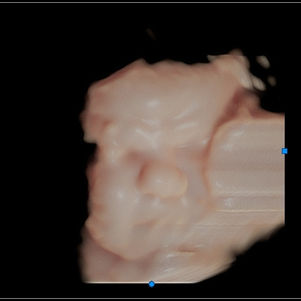 39 weeks pregnant 3D ultrasound picture of baby's face in virtual hd