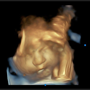 37 weeks 3 days pregnant 3d ultrasound baby face picture