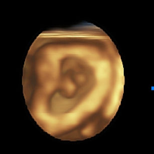 8 weeks pregnant 3d ultrasound of baby and yolk sac