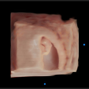 3D ultrasound picture at 9 weeks 4 days pregnant of baby in virtual HD